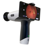 Видео камера за изследване на очно дъно