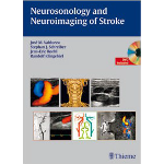 Невросонология и невровизуализация на инсулта, книга и DVD